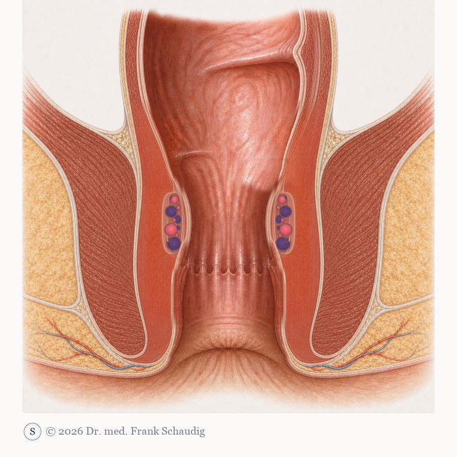 Hämorrhoiden, Gesund